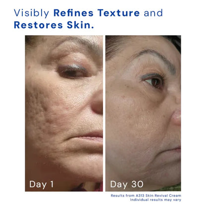 A313 Retinol Skin Removal Cream